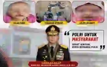 Bakti Kesehatan Polri: Operasi Celah Bibir dan Lelangit Gratis Digelar di Manado, Perayaan Hari Bhayangkara ke-80 Makin Bermakna